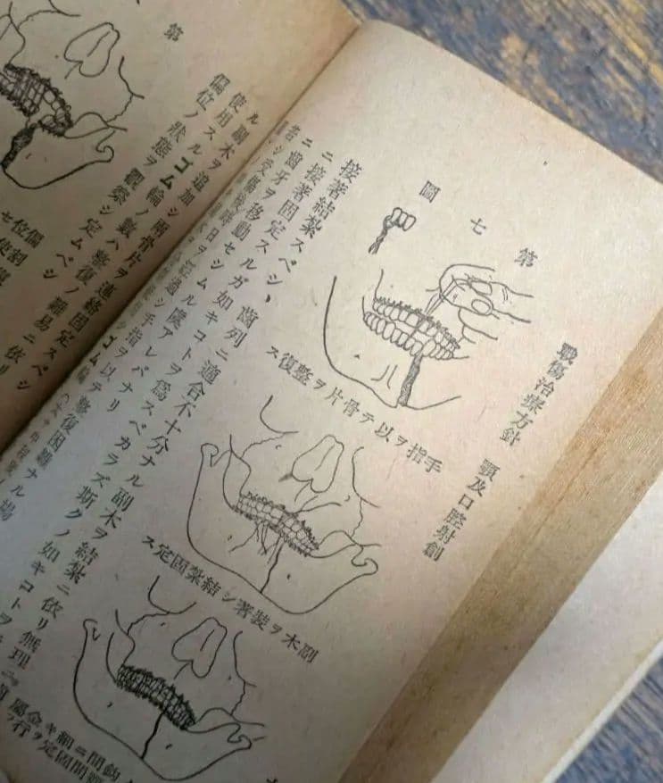 希少 戦前 医学書 戦傷治療 外科書 軍医資料 古書 昭和初期 激レア