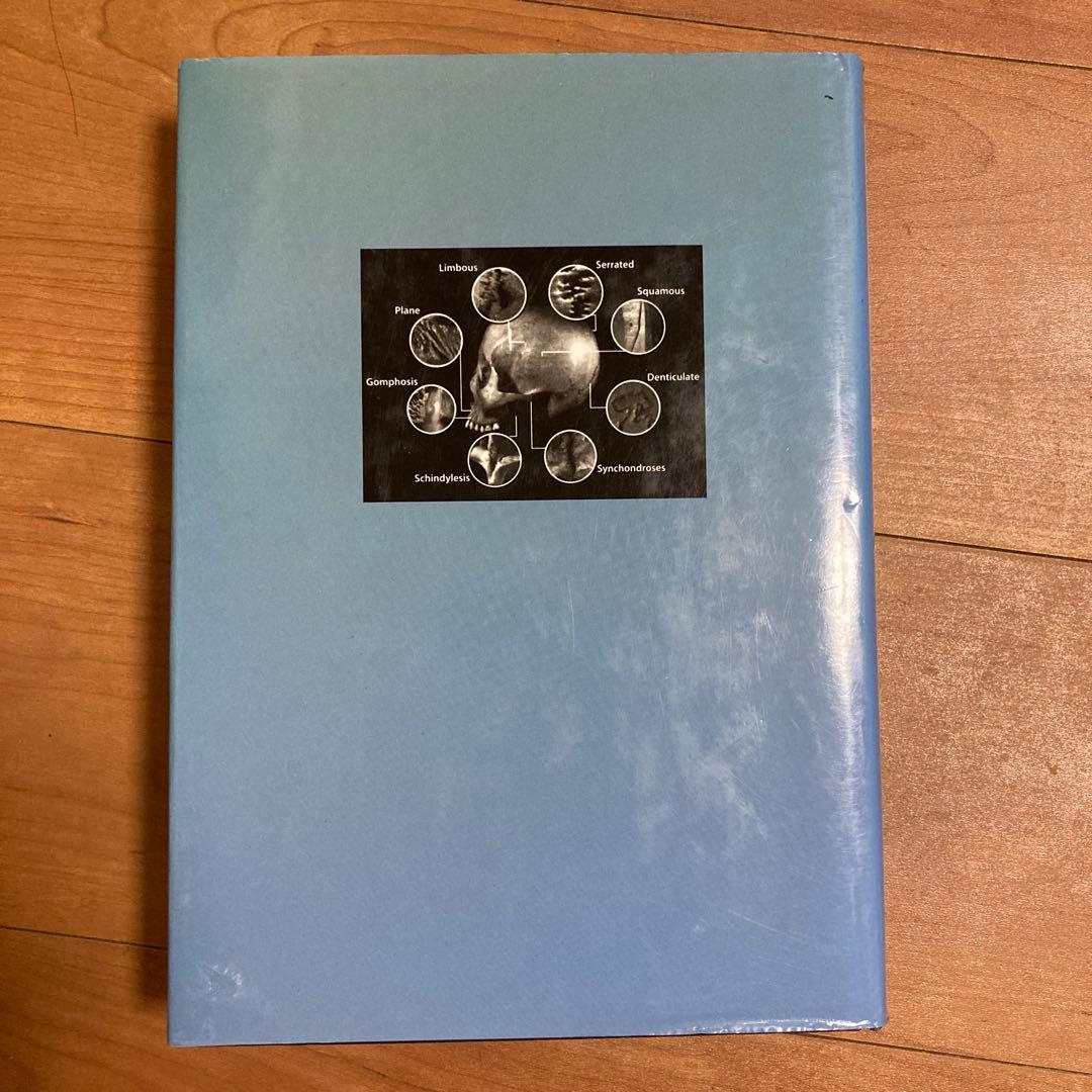 頭蓋縫合